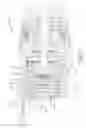 Fig. 10 - Tool having multi-speed compound planetary transmission