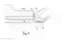 Fig. 04 - ELASTOMERIC GASKET SQUEEZE-OUT REMOVAL METHOD AND KIT