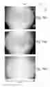 Fig. 23 - Method to manufacture a composite product with micro contoured surface layer
