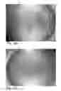 Fig. 24 - Method to manufacture a composite product with micro contoured surface layer