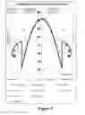 Fig. 08 - OVERMOULDING PROCESS HAVING INTERMEDIATE HEATING STEP