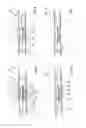 Fig. 06 - Method and device for applying at least one decorative strip to a seat cover