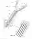 Fig. 08 - Method of recoupling components during reprocessing