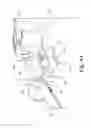 Fig. 11 - Automotive safety device