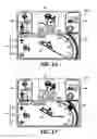 Fig. 14 - Predictive cruise control system with advanced operator control and feedback