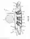 Fig. 18 - Pivot bin assembly with minimal force required for closing