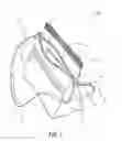 Fig. 02 - PROTECTIVE BAG