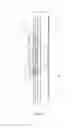 Fig. 02 - GUIDE RAIL ALIGNMENT SYSTEMS FOR ELEVATORS