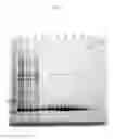 Fig. 02 - Non-Natural Consensus Albumin Binding Domains