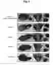 Fig. 04 - COMPOSITION COMPRISING RECOMBINANT FUSION PROTEIN OF PATHOGENIC ANTIGEN PROTEIN AND FLAGELLIN OF VIBRIO VULNIFICUS FOR PREVENTING, ALLEVIATING, OR TREATING AGING