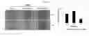 Fig. 18 - Development of Protein-Based Biotherapeutics That Penetrate Cell-Membrane and Induce Anti-Cancer Effect - Cell-Permeable Trefoil Factor 1 (CP-TFF1) in Gastrointestinal Track (GIT) Cancer, Polynucleotides Encoding The Same, and Anti-Cancer Compositions Comprising The Same