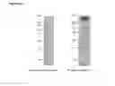 Fig. 11 - Methods and compositions for the treatment and/or prophylaxis of associated disease