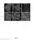 Fig. 22 - Bispecific HER2 and HER3 antigen binding constructs