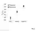 Fig. 07 - CROSSLINKED POLY-DEPSIPEPTIDE COPOLYMERS AND METHODS OF MAKING THEREOF