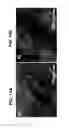 Fig. 15 - CROSSLINKED POLY-DEPSIPEPTIDE COPOLYMERS AND METHODS OF MAKING THEREOF