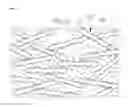 Fig. 13 - Organic-inorganic composite containing ceramic particles having fine projections on surface thereof