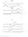 Fig. 04 - Process for manufacturing a part provided with a lubricating surface coating, part provided with such a coating and turbomachine