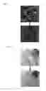 Fig. 05 - Method for deforming and/or fragmenting a cell, spore or virus with a vibrating plate