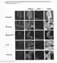 Fig. 07 - Methods for modulating cyclic nucleotide-mediated signaling in cardiac myocytes and compositions
