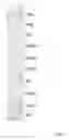 Fig. 02 - Highly simplified lateral flow-based nucleic acid sample preparation and passive fluid flow control