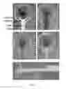 Fig. 09 - Highly simplified lateral flow-based nucleic acid sample preparation and passive fluid flow control