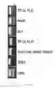 Fig. 13 - Highly simplified lateral flow-based nucleic acid sample preparation and passive fluid flow control