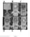 Fig. 19 - Highly simplified lateral flow-based nucleic acid sample preparation and passive fluid flow control