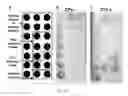 Fig. 20 - Highly simplified lateral flow-based nucleic acid sample preparation and passive fluid flow control