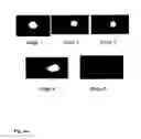 Fig. 22 - Synthetic lethality in cancer