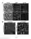 Fig. 12 - Compositions and methods for treating cancer