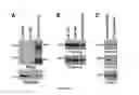 Fig. 13 - Compositions and methods for treating cancer