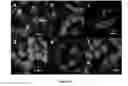 Fig. 10 - PRODUCTION OF BACTERIAL MICROCOMPARTMENTS IN EUKARYOTIC CELLS