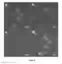 Fig. 15 - PRODUCTION OF BACTERIAL MICROCOMPARTMENTS IN EUKARYOTIC CELLS