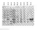 Fig. 04 - Method for late introduction of the () hydroxyl group carbapenem β-lactam antibiotic synthesis