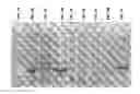 Fig. 05 - Method for late introduction of the () hydroxyl group carbapenem β-lactam antibiotic synthesis