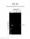 Fig. 53 - Recombinase polymerase amplification