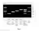 Fig. 02 - Sequence specific primer pool for multiplex PCR and method of detecting microbial infections in thalassemia patients