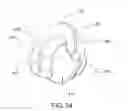 Fig. 33 - Ground engaging tool assembly