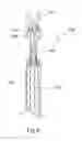 Fig. 05 - Non-point pollutant source treatment apparatus