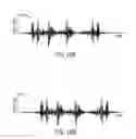 Fig. 14 - Autonomous untethered well object