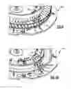 Fig. 08 - Method and fixture for airfoil array assembly