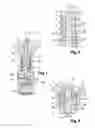 Fig. 02 - High Pressure Pump