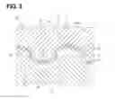 Fig. 04 - Planetary gear train of internal engagement type