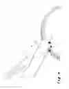 Fig. 03 - Method of providing a predetermined backlash for a transmission, a method for applying a sheet of spacer material to at least part of an upright sidewall of a first toothed gear