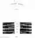 Fig. 03 - Piston ring