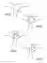 Fig. 11 - Valve