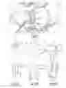 Fig. 17 - Valve