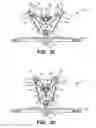 Fig. 06 - Anti-flutter check valve