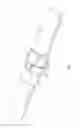 Fig. 02 - Fire hose girdle