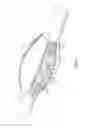 Fig. 05 - Fire hose girdle